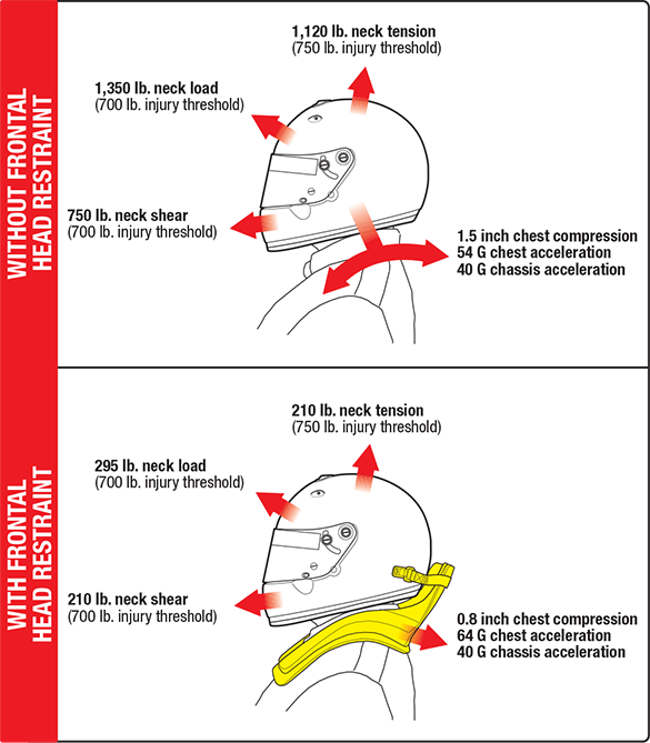 Head Restraint Physics